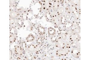 ABIN6267407 at 1/200 staining human kidney tissue sections by IHC-P. (PKC alpha 抗体  (pThr638))