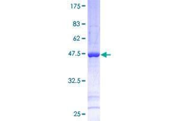SNX12 Protein (AA 1-172) (GST tag)