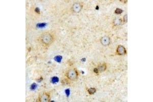 Immunohistochemical analysis of VILIP-1 staining in mouse brain formalin fixed paraffin embedded tissue section. (VSNL1 抗体)