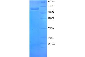 Small Nuclear Ribonucleoprotein Polypeptide A (SNRPA) (AA 8-278), (partial) protein (GST tag) (SNRPA1 Protein (AA 8-278, partial) (GST tag))