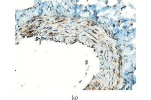 Immunohistochemical staining for MCP-1 in the graft vessels (original magnification x400). (CCL2 抗体  (AA 61-148))