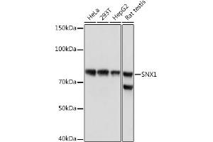Western blot analysis of extracts of various cell lines, using SNX1 Rabbit mAb (ABIN7270502) at 1:1000 dilution. (Sorting Nexin 1 抗体)