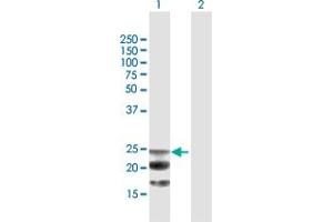 Western Blot analysis of NAAA expression in transfected 293T cell line by NAAA MaxPab polyclonal antibody. (NAAA 抗体  (AA 1-199))