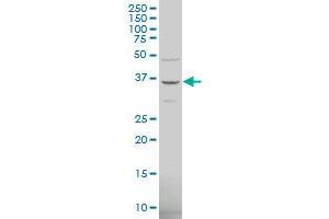 TRIM6-TRIM34 polyclonal antibody (A01), Lot # 051115JCO1 Western Blot analysis of TRIM6-TRIM34 expression in Hela S3 NE . (TRIM6-TRIM34 抗体  (AA 641-740))