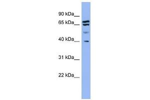 SH3GL2 antibody used at 1 ug/ml to detect target protein. (SH3G2 抗体  (Middle Region))