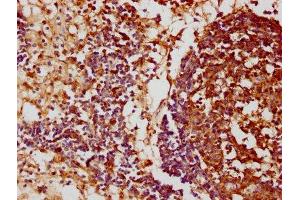 IHC image of ABIN7152658 diluted at 1:100 and staining in paraffin-embedded human lymph node tissue performed on a Leica BondTM system.