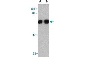 Western blot analysis of PRDM1 in A-549 cell lysate with PRDM1 polyclonal antibody  at (A) 0. (PRDM1 抗体  (C-Term))