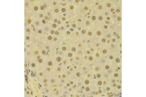 Immunohistochemistry (Paraffin-embedded Sections) (IHC (p)) image for anti-COP9 Constitutive Photomorphogenic Homolog Subunit 5 (Arabidopsis) (COPS5) (AA 1-334) antibody (ABIN3022512)