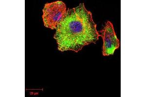 Immunocytochemistry (ICC) image for anti-Tubulin, beta 1 (TUBB1) (AA 33-166) antibody (ABIN5879491) (TUBB1 抗体  (AA 33-166))