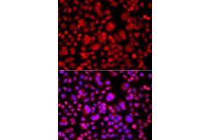 Immunofluorescence analysis of A549 cell using TP53BP2 antibody. (TP53BP2 抗体)