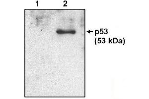 Western Blotting (WB) image for anti-Tumor Protein P53 (TP53) (AA 371-380) antibody (ABIN264449) (p53 抗体  (AA 371-380))