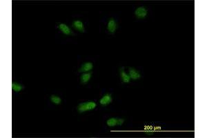 Immunofluorescence of monoclonal antibody to CSE1L on HeLa cell. (Exportin 2 抗体  (AA 872-971))
