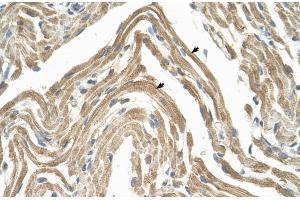 Human Muscle (CCBP2 抗体  (N-Term))