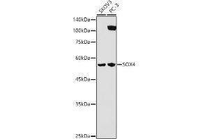 Western blot analysis of extracts of various cell lines, using SOX4 antibody (ABIN7270575) at 1:1000 dilution. (SOX4 抗体  (AA 1-100))