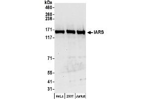 Western Blotting (WB) image for anti-Isoleucyl-tRNA Synthetase (IARS) (AA 1-50) antibody (ABIN7450347)