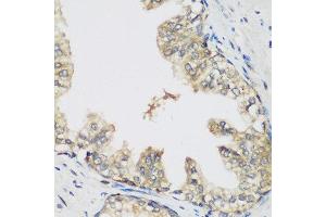 Immunohistochemistry of paraffin-embedded human prostate using RRM1 antibody at dilution of 1:200 (40x lens). (RRM1 抗体)