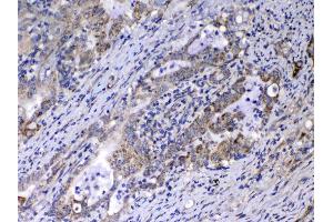 IHC analysis of Relaxin 1 using anti-Relaxin 1 antibody . (Relaxin 1 抗体)