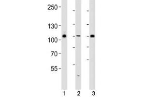 Western blot analysis of lysate from 293, HUVEC, T47D cell line (left to right) using GAB1 antibody diluted at 1:1000 for each lane. (GAB1 抗体  (AA 250-285))