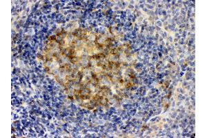 Immunohistochemistry (IHC) image for anti-Sequestosome 1 (SQSTM1) (AA 69-96), (N-Term) antibody (ABIN3043937)