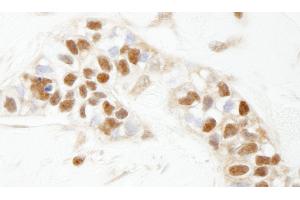Immunohistochemistry (IHC) image for anti-Poly (ADP-Ribose) Polymerase 1 (PARP1) (AA 50-100) antibody (ABIN7448996)