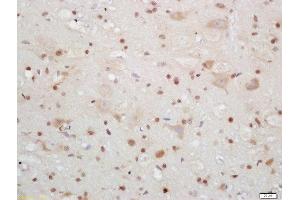 Formalin-fixed and paraffin embedded mouse brain labeled with Rabbit Anti-CIRBP Polyclonal Antibody, Unconjugated (ABIN872483) at 1:200 followed by conjugation to the secondary antibody and DAB staining (CIRBP 抗体  (AA 61-172))
