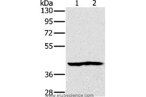Western blot analysis of Mouse heart and kidney tissue, using NDUFA10 Polyclonal Antibody at dilution of 1:450 (NDUFA10 抗体)