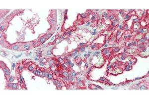 Immunohistochemistry of paraffin-embedded Kidney tissue using CD151 Polyclonal Antibody at dilution of 1:120.