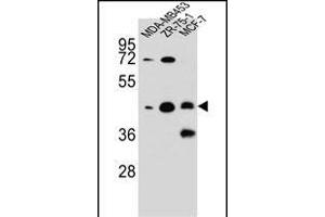 hCG_1645727 Antibody (C-term) (ABIN656073 and ABIN2845421) western blot analysis in MDA-M,ZR-75-1,MCF-7 cell line lysates (35 μg/lane). (KBTBD13 抗体  (C-Term))