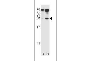 Western blot analysis of IL27 using rabbit polyclonal IL27 Antibody (C71) using 293 cell lysates (2 ug/lane) either nontransfected (Lane 1) or transiently transfected (Lane 2) with the IL27 gene.