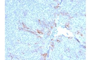 Immunohistochemistry (IHC) image for anti-Hepatitis A Virus Cellular Receptor 2 (TIM 3) (AA 22-202) antibody (ABIN6940963)