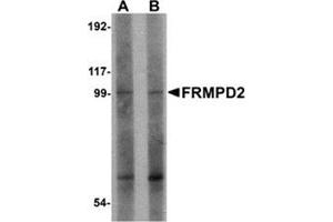 Western blot analysis of FRMPD2 in rat kidney tissue lysate with FRMPD2 antibody at (A) 1 and (B) 2 μg/ml. (FRMPD2 抗体  (N-Term))
