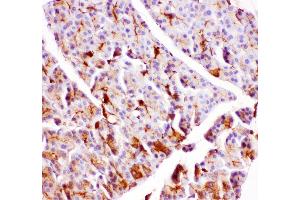 Anti- GPX1 antibody, IHC(P) IHC(P): Rat Pancreas Tissue (Glutathione Peroxidase 1 抗体  (Middle Region))