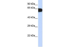 Western Blotting (WB) image for anti-T-Box 18 (TBX18) antibody (ABIN2458234) (T-Box 18 抗体)