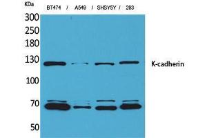 Western Blot (WB) analysis of BT474, A549, SHSY5Y, 293 cells using K-cadherin Polyclonal Antibody. (CDH6 抗体  (Internal Region))