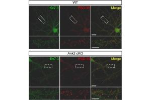 Effects of Ank2 cKO on the localization of Kv7.