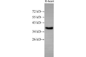 Western Blot analysis of Rat Heart using EpCAM Polyclonal Antibody at dilution of 1:500 (EpCAM 抗体)