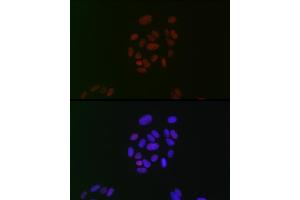Immunofluorescence analysis of U-2 OS cells using CIRBP Rabbit mAb (ABIN7266452) at dilution of 1:100 (40x lens). (CIRBP 抗体)