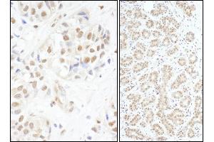 Immunohistochemistry (IHC) image for anti-V-Myb Myeloblastosis Viral Oncogene Homolog (Avian) (MYB) (AA 1-50) antibody (ABIN7453466) (MYB 抗体  (AA 1-50))