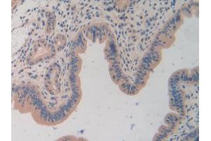 DAB staining on IHC-P; Samples: Mouse Uterus Tissue (TOR1A 抗体  (AA 41-333))