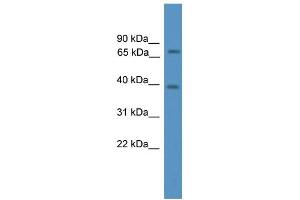 Western Blotting (WB) image for anti-Nuclear Receptor Coactivator 4 (NCOA4) (N-Term) antibody (ABIN2780237)