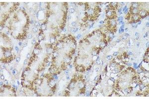 Immunohistochemistry (Paraffin-embedded Sections) (IHC (p)) image for anti-Methylenetetrahydrofolate Dehydrogenase (NADP+ Dependent) 2, Methenyltetrahydrofolate Cyclohydrolase (MTHFD2) antibody (ABIN7255295)