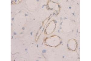 Figure. (PMP22 抗体  (AA 31-133))