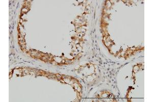 Immunostaining (ISt) image for anti-Serine Dehydratase-Like (SDSL) (AA 1-329) antibody (ABIN566704)