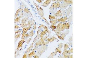Immunohistochemistry of paraffin-embedded rat heart using WSB2 antibody (ABIN6133280, ABIN6150269, ABIN6150270 and ABIN6216800) at dilution of 1:100 (40x lens). (WSB2 抗体  (AA 1-200))