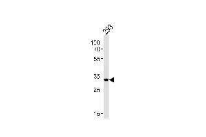 Western Blotting (WB) image for anti-STIP1 Homology and U-Box Containing Protein 1 (STUB1) (AA 236-263), (C-Term) antibody (ABIN656111)