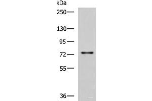 Western blot analysis of Rat liver tissue lysate using TGFBI Polyclonal Antibody at dilution of 1:850 (TGFBI 抗体)