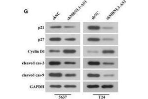Inhibition of MBNL1-AS1 promoted the tumorigenesis of BC cells through the regulation of miR-135a/PHLPP2/FOXO1 in vivo. (Cyclin D1 抗体  (AA 96-295))