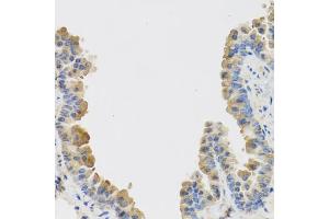 Immunohistochemistry of paraffin-embedded mouse lung using IL25 antibody (ABIN5974535) at dilution of 1/100 (40x lens). (IL-25 抗体)