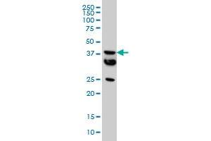 Western Blotting (WB) image for anti-Malonyl CoA:ACP Acyltransferase (Mitochondrial) (MCAT) (AA 291-391) antibody (ABIN599223)