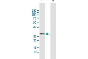 Western Blot analysis of MPZL2 expression in transfected 293T cell line by MPZL2 MaxPab polyclonal antibody. (MPZL2 抗体  (AA 1-215))